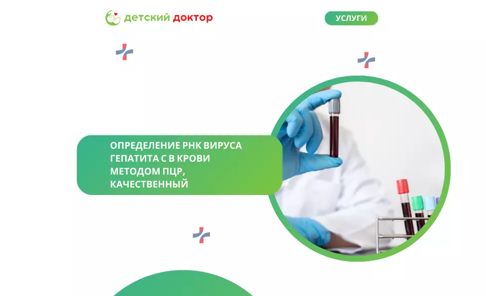 Определение РНК вируса гепатита С в крови методом ПЦР, качественный